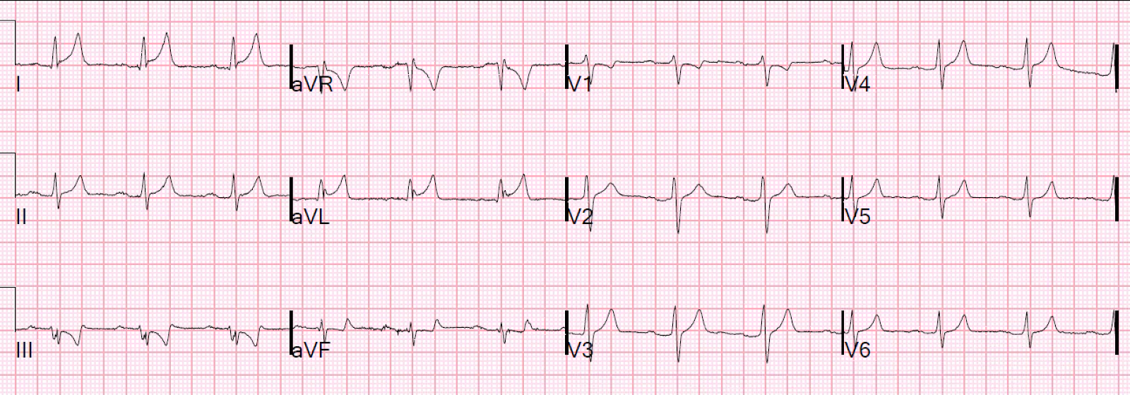 Royals lead the nation in sending good luck messages to the Lionesses ... Royals lead the nation in sending good luck messages to the Lionesses ...